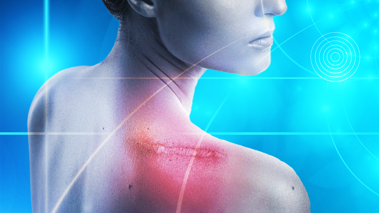 NeuEra - La Peau et le Fascia - Déparasitage Bioélectrique et Réintégration Sensorielle