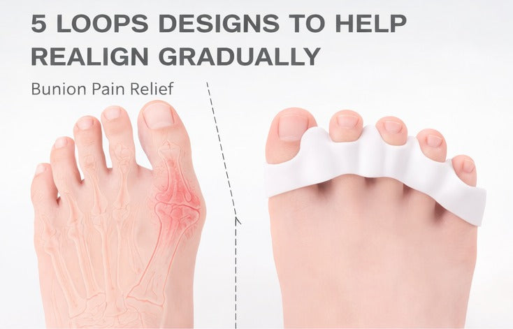 Toe spreader