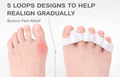 Toe spreader